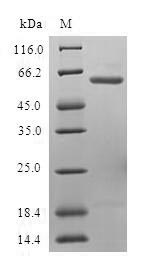 Recombinant Human Ubiquitin fusion degradation protein 1 homolog (UFD1L)