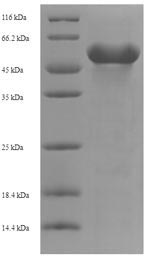 Recombinant Human Kynurenine/alpha-aminoadipate aminotransferase, mitochondrial (AADAT)
