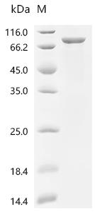 Recombinant Human Kynurenine/alpha-aminoadipate aminotransferase, mitochondrial (AADAT)