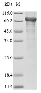 Recombinant Mouse 5-aminolevulinate synthase, nonspecific, mitochondrial (Alas1)