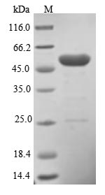 Recombinant Human Pleckstrin homology-like domain family A member 1 (PHLDA1)