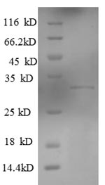 Recombinant Human Killer cell lectin-like receptor subfamily G member 1 (KLRG1), partial