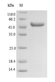 Recombinant Human Succinyl-CoA ligase [GDP-forming] subunit beta, mitochondrial (SUCLG2), partial