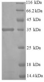 Recombinant Human Protein disulfide-isomerase TMX3 (TMX3)