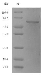 Recombinant Escherichia coli O157:H7 Phosphoribosylamine--glycine ligase (purD)