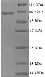 Recombinant Human Probable imidazolonepropionase (AMDHD1)