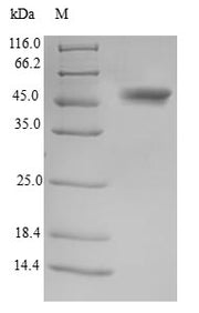 Recombinant Human Testis-specific serine/threonine-protein kinase 3 (TSSK3)
