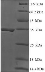 Recombinant Human DAN domain family member 5 (DAND5)
