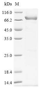 Recombinant Human Mixed lineage kinase domain-like protein (MLKL)