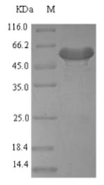 Recombinant Mouse Platelet-derived growth factor D (Pdgfd)