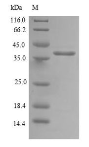 Recombinant Human Mitochondrial import inner membrane translocase subunit TIM14 (DNAJC19)