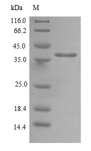 Recombinant Human Mitochondrial import inner membrane translocase subunit TIM14 (DNAJC19)