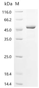 Recombinant Human F-box only protein 22 (FBXO22)