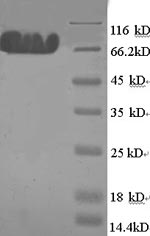 Recombinant Human E3 ubiquitin-protein ligase MYLIP (MYLIP)