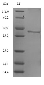 Recombinant Arabidopsis thaliana Sucrose-phosphate synthase 1 (SPS1), partial