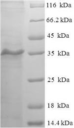 Recombinant Human Myosin regulatory light chain 2, skeletal muscle isoform (MYLPF)