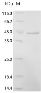 Recombinant Human P2X purinoceptor 7 (P2RX7), partial