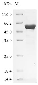 Recombinant Human Selenide, water dikinase 2 (SEPHS2) (U60S)