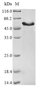 Recombinant Human Homeobox protein Meis3 (MEIS3)