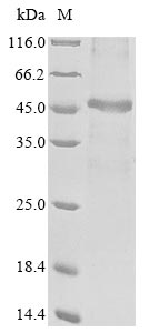 Recombinant Human ADP-ribose glycohydrolase MACROD1 (MACROD1)