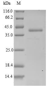 Recombinant Human Actin-related protein 2/3 complex subunit 5-like protein (ARPC5L)