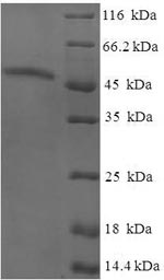 Recombinant Human AKT-interacting protein (AKTIP)