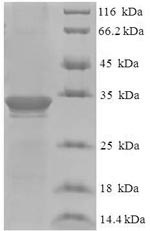 Recombinant Human Dysbindin domain-containing protein 2 (DBNDD2)