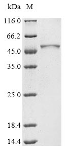 Recombinant Human Plasma alpha-L-fucosidase (FUCA2)