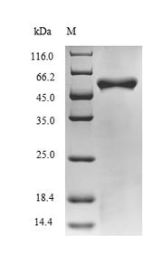 Recombinant Halalkalibacterium halodurans Putative adenine deaminase BH0637 (BH0637), partial