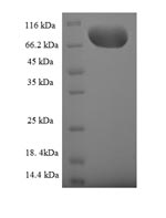 Recombinant Human Guanine nucleotide-binding protein-like 3-like protein (GNL3L)