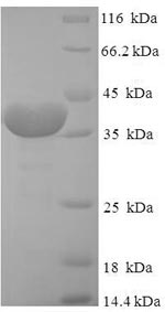 Recombinant Human Peptidyl-prolyl cis-trans isomerase FKBP14 (FKBP14)