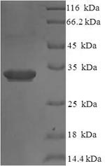 Recombinant Human Interleukin-36 receptor antagonist protein (IL36RN)
