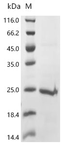 Recombinant Human Protein tweety homolog 1 (TTYH1), partial