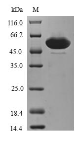Recombinant Human AN1-type zinc finger protein 3 (ZFAND3)