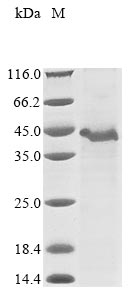 Recombinant Human A disintegrin and metalloproteinase with thrombospondin motifs 9 (ADAMTS9), partial