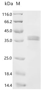 Recombinant Mouse Nephrin (Nphs1), partial