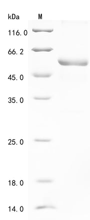 Recombinant Human Complement C1q tumor necrosis factor-related protein 1 (C1QTNF1)