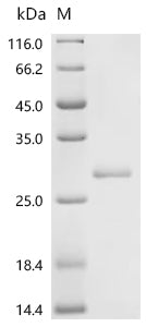 Recombinant Mouse Gamma-interferon-inducible lysosomal thiol reductase (Ifi30)