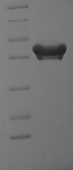 Recombinant Human MOB kinase activator 1A (MOB1A)