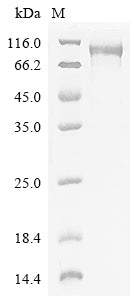 Recombinant Human Band 4.1-like protein 5 (EPB41L5)