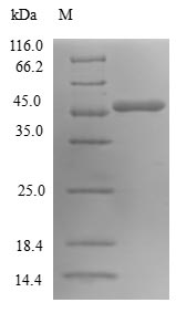 Recombinant Human GTP-binding protein SAR1a (SAR1A)