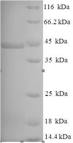 Recombinant Pseudomonas aeruginosa Lysyl endopeptidase (prpL)
