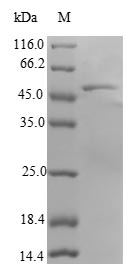 Recombinant Human Ras-related protein Rab-18 (RAB18)