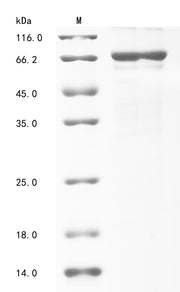 Recombinant Human Insulin-like growth factor 2 mRNA-binding protein 1 (IGF2BP1)