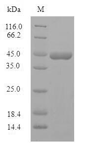 Recombinant Human Protein phosphatase 1 regulatory subunit 1B (PPP1R1B)