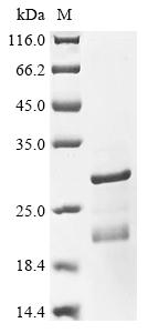 Recombinant Human Protein phosphatase 1 regulatory subunit 1B (PPP1R1B)