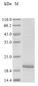 Recombinant Human DET1- and DDB1-associated protein 1 (DDA1)