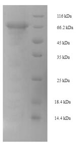 Recombinant Mouse Pancreatic secretory granule membrane major glycoprotein GP2 (Gp2)