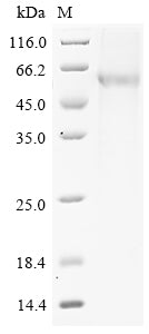 Recombinant Mouse Pancreatic secretory granule membrane major glycoprotein GP2 (Gp2)