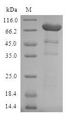 Recombinant Human Aryl-hydrocarbon-interacting protein-like 1 (AIPL1)